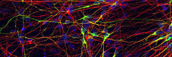 Fluoreszenz-Aufnahme menschlicher Stammzellen, die aus iPS-Zellen hergestellt wurden. © MPI für molekulare Biomedizin Münster