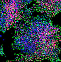 Fluorescence image of human stem cells generated from iPs cells.