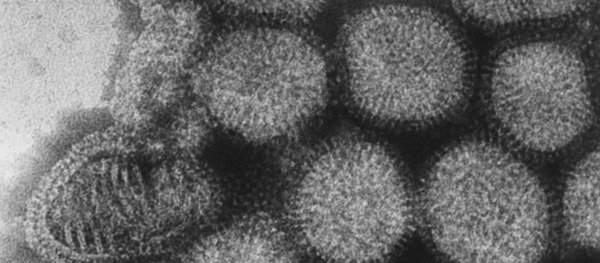 Partikel des Influenza-A-Virus. Die Erreger sind eng mit dem Vogelgrippe-Virus verwandt. (c:  MPI f. Virusforschung/ H. Frank)