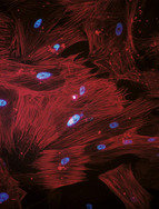 Induzierte pluripotente Stammzellen - von Spezialisten zu Alleskönnern