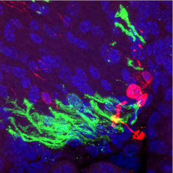 Cell-based method for the regeneration of myelin | Max-Planck-Gesellschaft