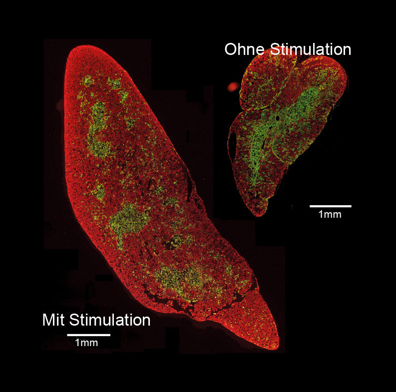 Composition of microscopy images on black background showing stimulated (larger) and unstimulated (much smaller) thymi from mice. The tissues are stained with flurorescent reagents (red and green). 