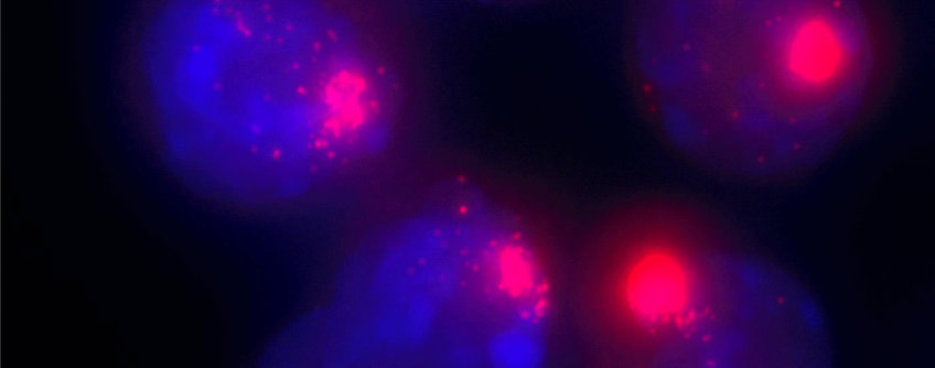 Nuclei of female cells. The Xist molecules, which are responsible for the inactivation of the second X chromosome, are marked with a red dye. Copyright: MPI for Molecular Genetics / Verena Mutzel