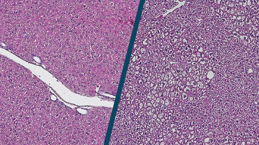 The structure of the liver changes with age.  Shown here is a histological image of young (left) and old (right) liver cells.