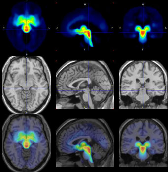 9 brain images taken from different sides, some with colored highlights