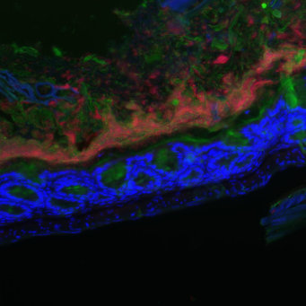 Stained intestinal bacteria (red: bacteria, blue: nucleus, green: mucus)
