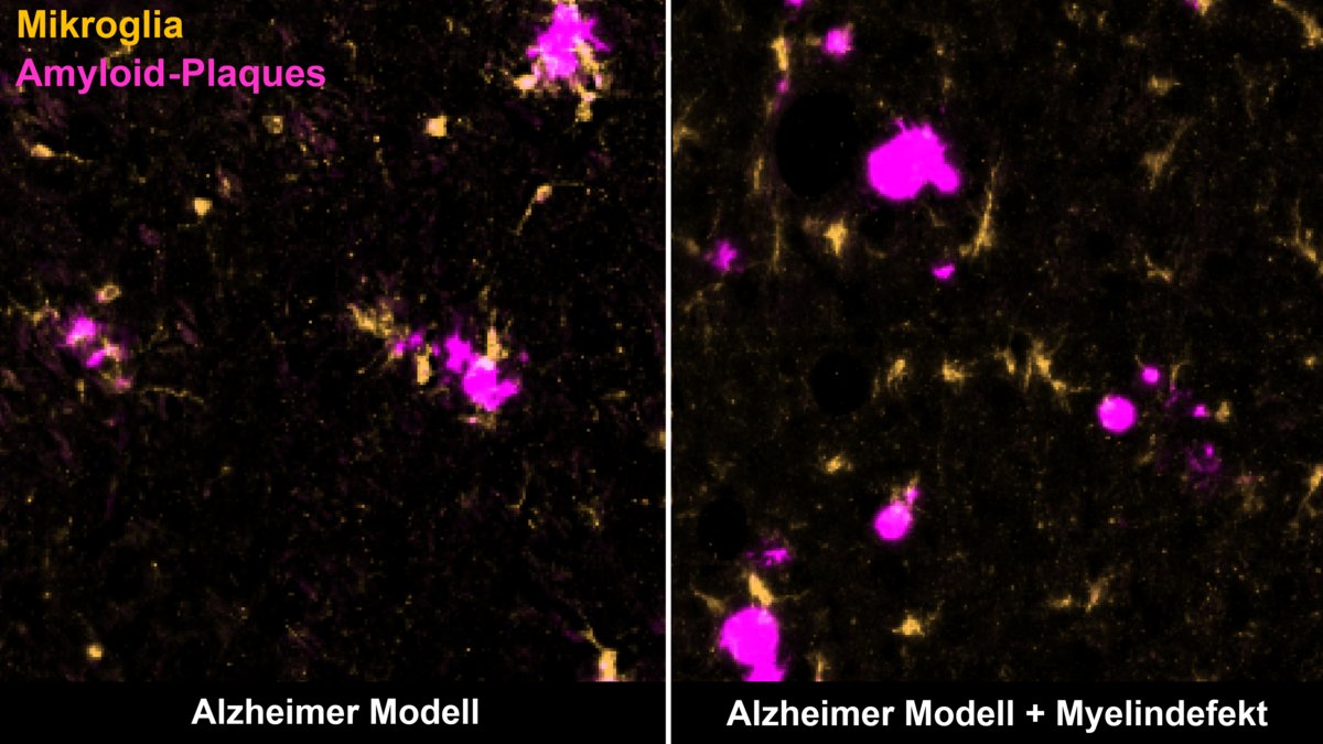 Poorly isolated neurons promote Alzheimer’s disease in old age