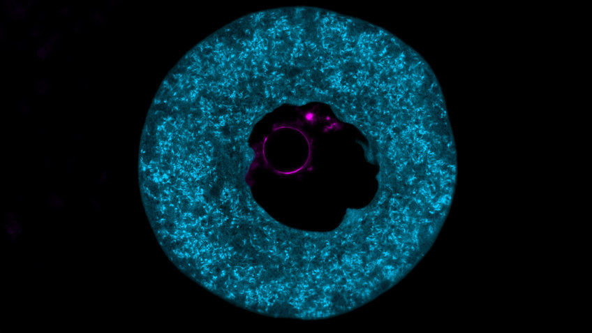 A mouse egg cell, naturally filled with the protein PADI6 (blue) - a marker and main component of the cytoplasmic lattice. The DNA in the cell nucleus is shown in magenta.