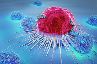 Democratizing cancer screenings