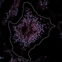 En esta célula, el receptor 7 tipo Toll se tiñó de rosa para analizar su número y ubicación bajo el microscopio.  La célula está sana y el número de receptores tipo Toll es normal.  La situación es diferente con las células inmunes de los pacientes con lupus, que tienen un mayor número de receptores.  Esto reconoce el material genético del propio cuerpo y provoca una inflamación crónica en el lupus. 
