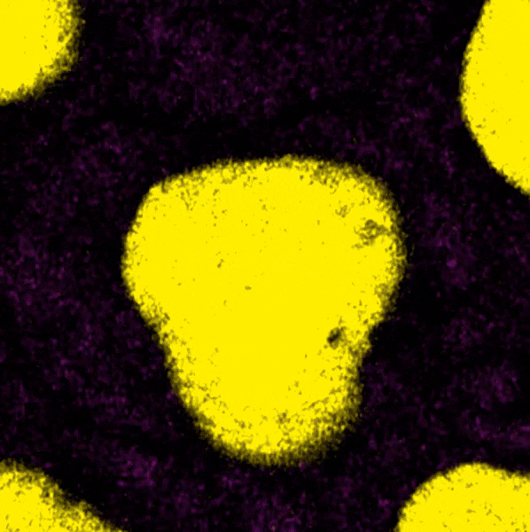 Live cell imaging of HeLa cells: After UV-induced RNA damage, the DHX9 (yellow) and G3BP1 (purple) proteins form stress granules after cell division.  