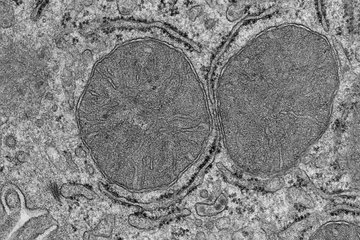 Electron micrograph of two mitochondria.