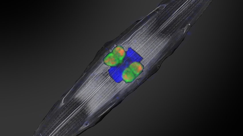 The Rhizobial nitrogen fixing symbionts (fluorescently-labeled in orange and green using genetic probes) residing inside diatoms collected from the tropical North Atlantic. The nucleus of the diatom is shown in bright blue.