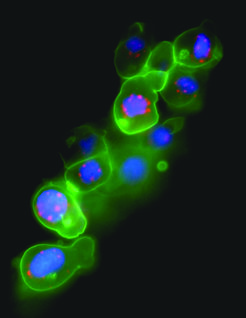 Expression von Keimzell-spezifischen Proteinen. Ein Beispiel für die Expression von Fluoreszenzproteinen unter Verwendung von spezifischen RNA-Sequenz